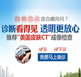 廣州308準分子激光