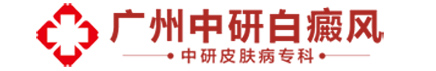 廣東中研白癜風